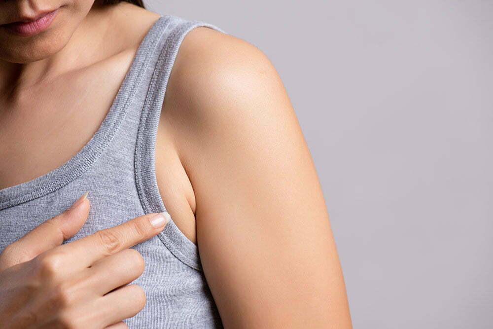 How to Get Rid of Armpit and Axillary Breast Fat